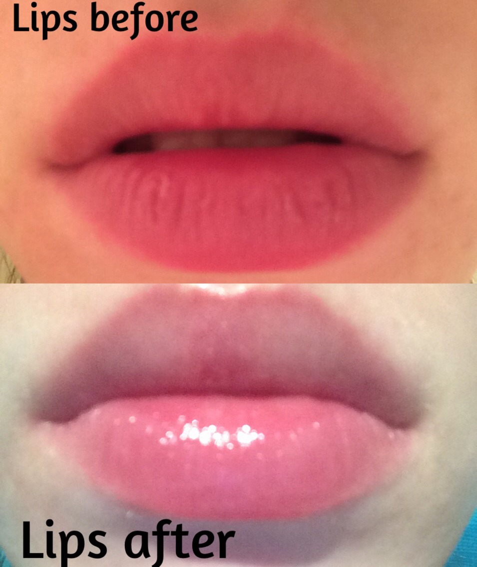 How To Get Rid Of Chapped Lips In 10 Easy Steps 👍👄👄👄