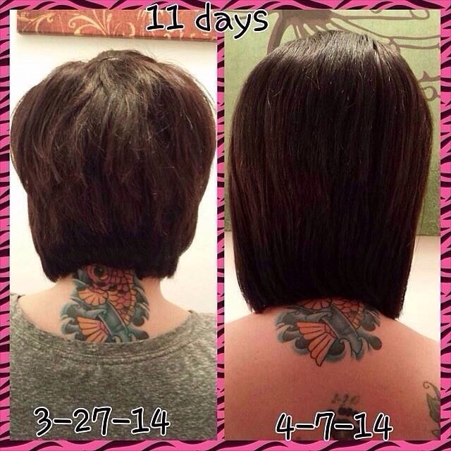 Easy Way To Grow Hair Back Fast