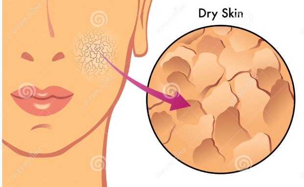 Repairs dry skin