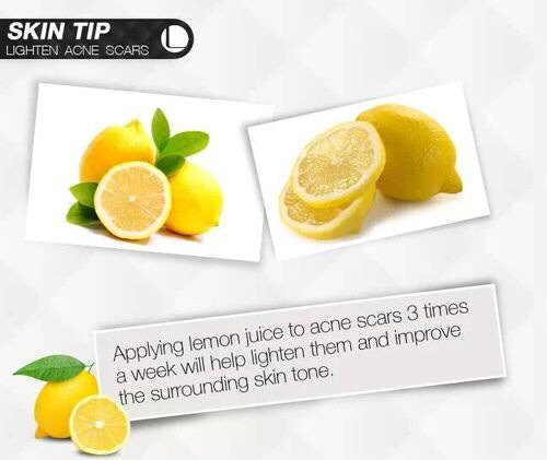 How To get Rid Of Acne Scars..the Natural Way