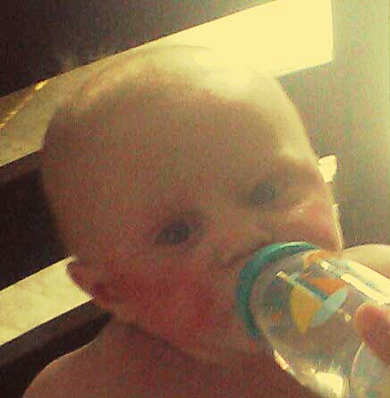 This was before I started treatment on his cheeks. You could tell that they are really bright red and they looked kind of swollen at that time.
Im sorry for the photo quality I had a bad camera back then.
