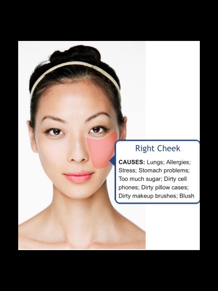 Face Mapping-What Your Acne Telling You? 😱👍👍