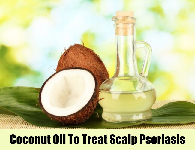 #7- use coconut oil. I've tried many creams and ointments prescribed by the dermatologist but no one has been as effective than coconut oil. Rub some coconut oil all over your scalp before going to bed and wash your hair in the morning. 
