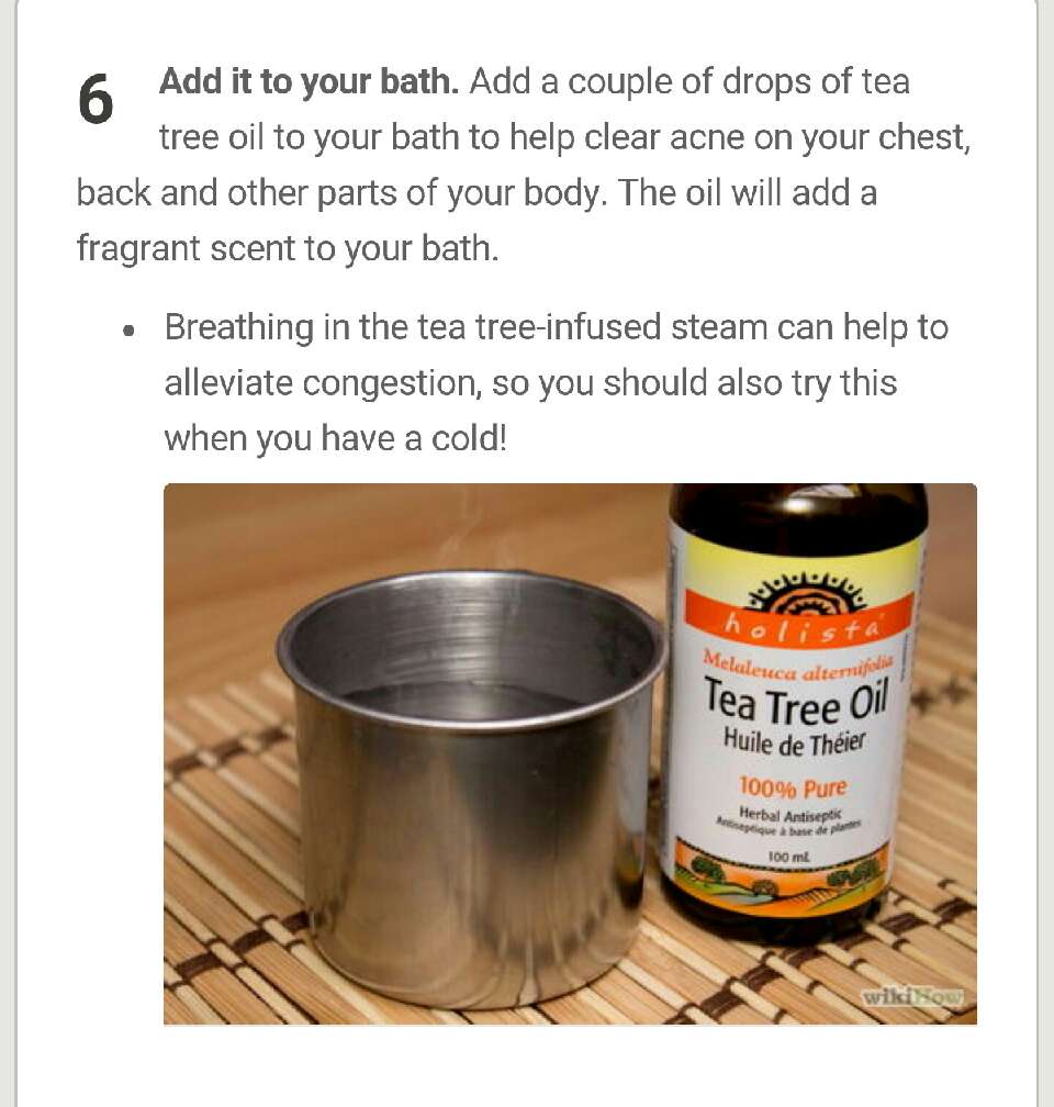 Tea Tree Oil for Acne