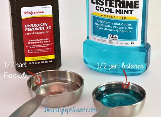 •Homemade Teeth Whitener Recipe
Step 1: — Mix 1/2 part of hydrogen peroxide to 1/2 part of Listerine (or any mouthwash) then gargle the mixture for about a minute and rinse out the mouth.