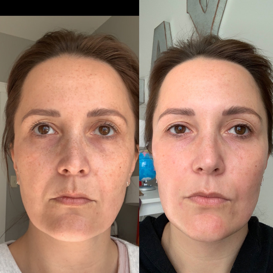 Customer photo