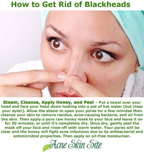 5. Steam your face with a hot towel or water to open up your pores before you try a treatment.