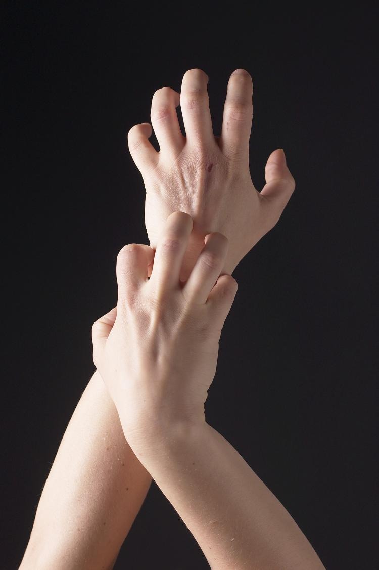 While having itchy skin apply pressure to the affected area, the reduce in blood flow will stop it from being irritated
