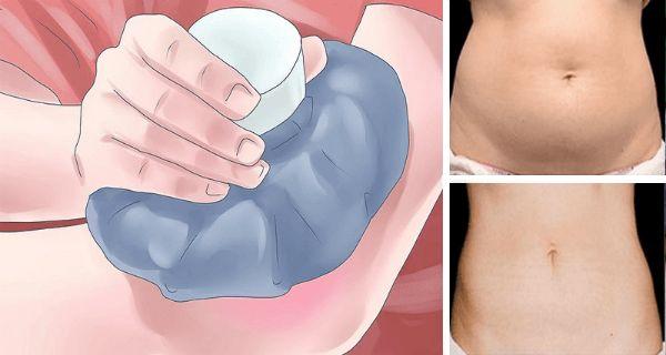 Kill Fat Cells Instantly Just By Freezing Them! 