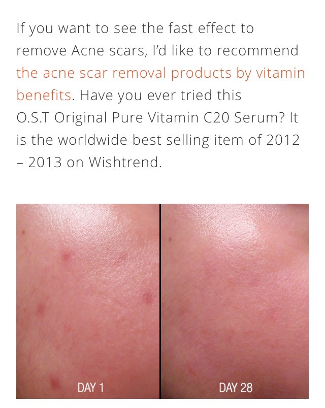 Acne Scar Removal Tips for Flawless Skin😍😍😍