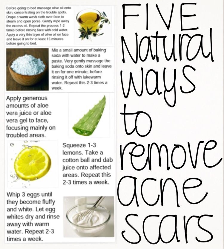Natural Ways To Remove Acne Scars. 