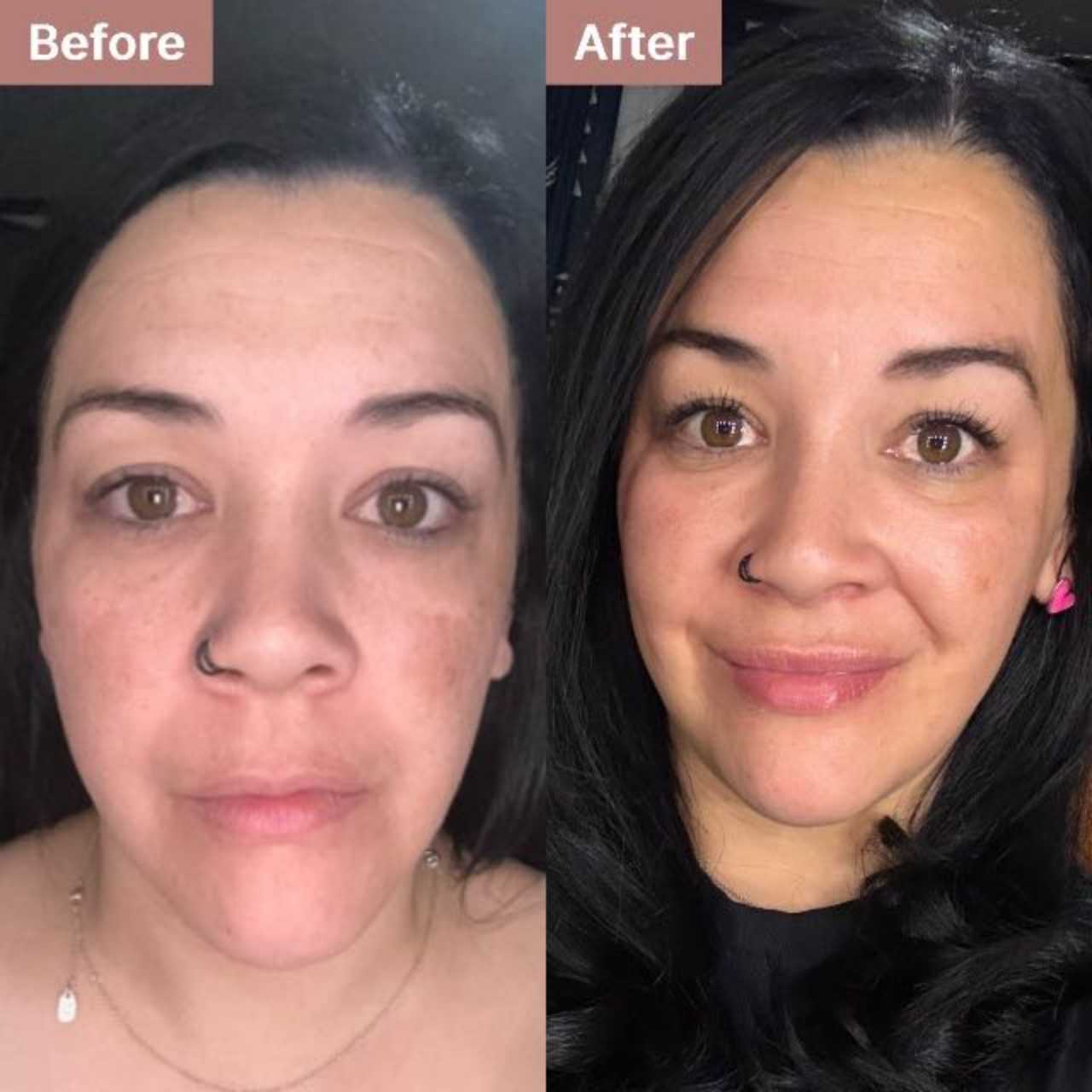 Laura -- before and after, 3 weeks