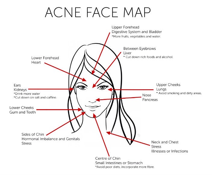 ACNE AND WHAT IT MEANS