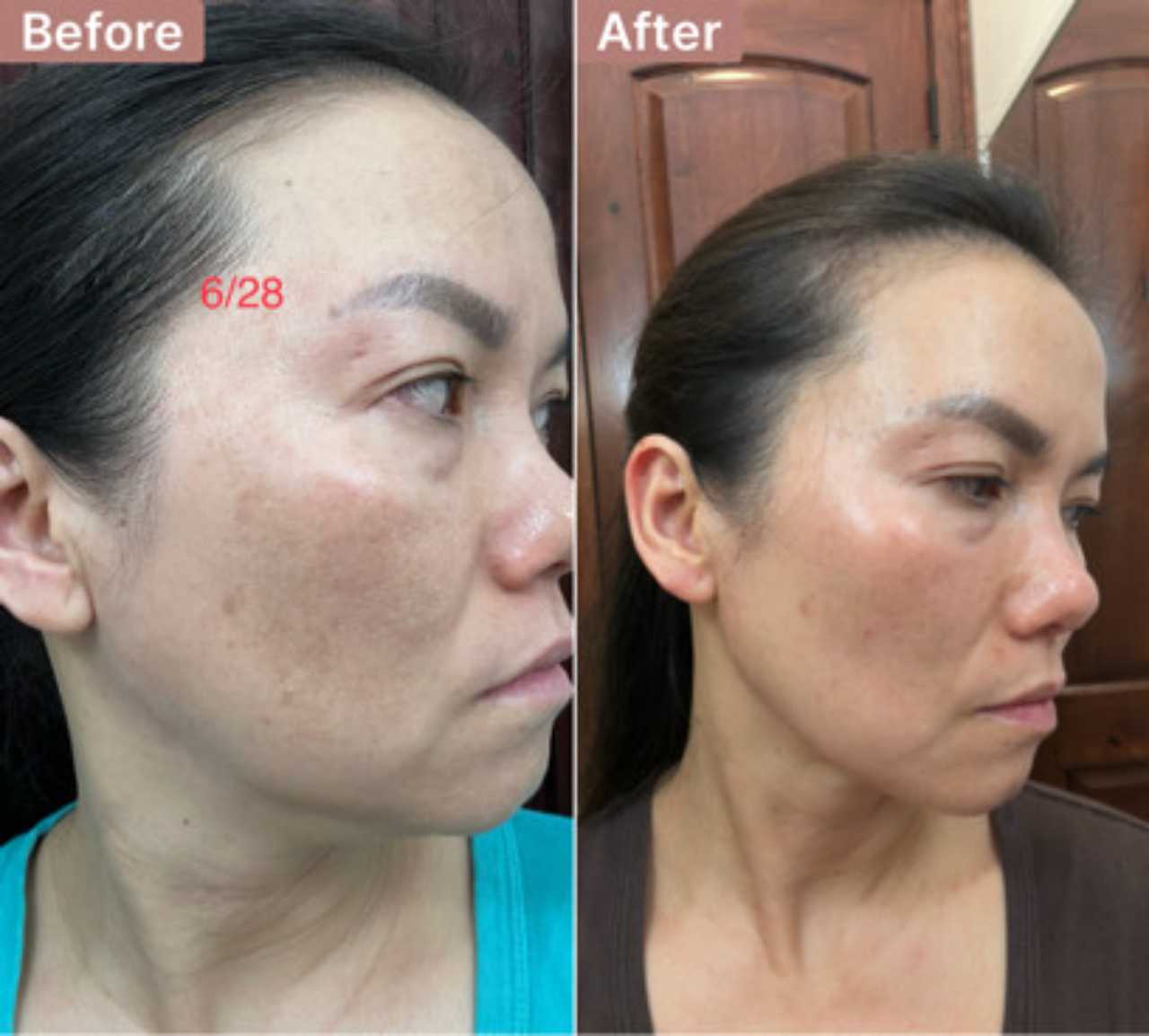 user-9-8277 -- before and after, 8 weeks