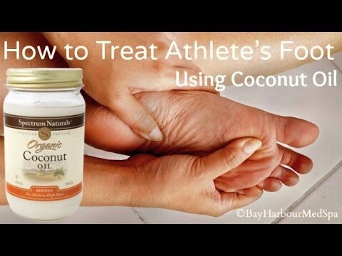 14. Use on feet to fight athlete’s foot or tor fungus.