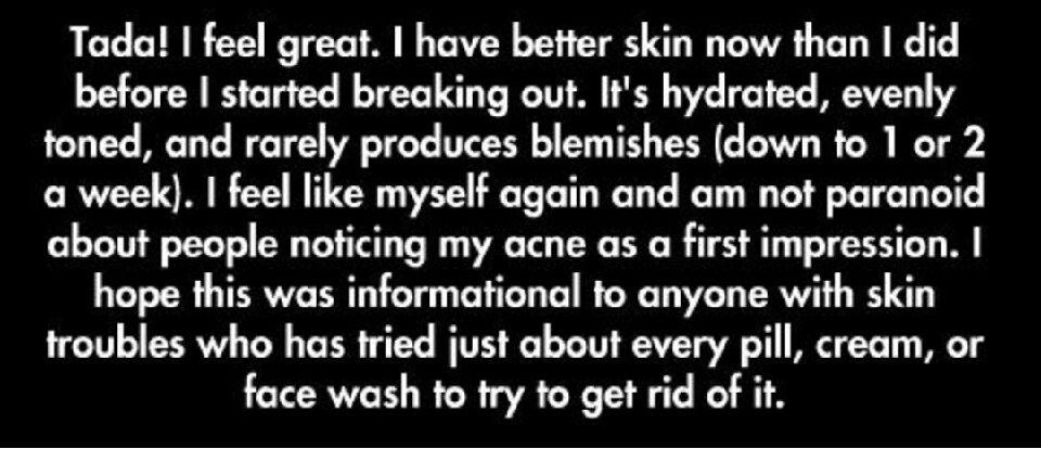 Natural Acne Prevention/ Treatment, bye bye Antibiotics! 