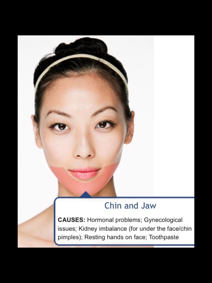 Face Mapping-What Your Acne Telling You? 😱👍👍