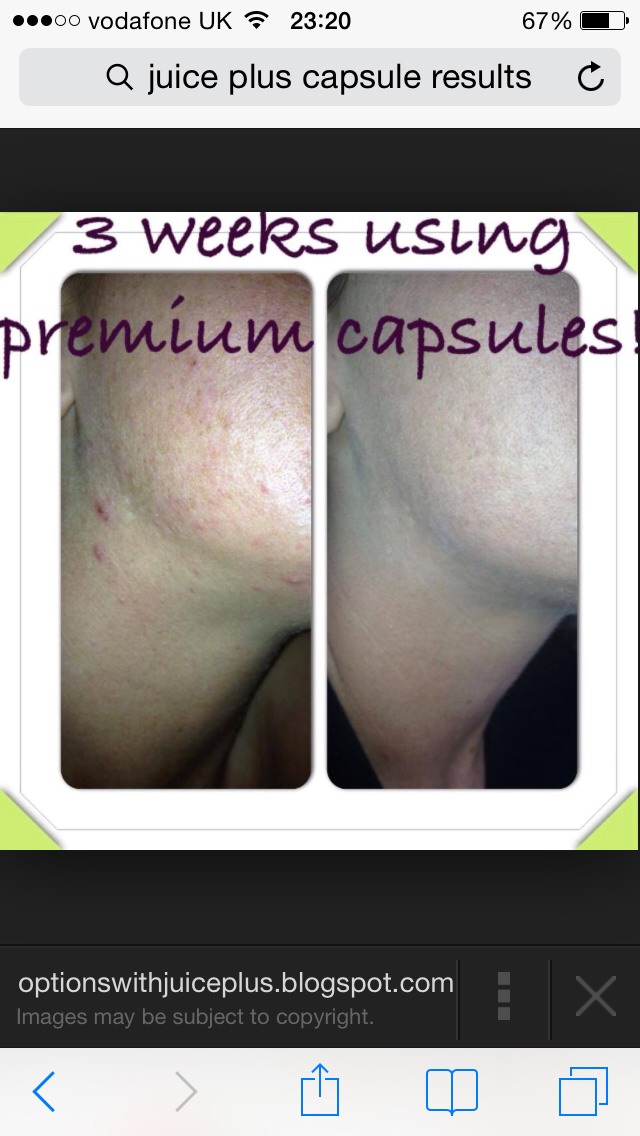 Want Healthy Hair, Skin And Nails?