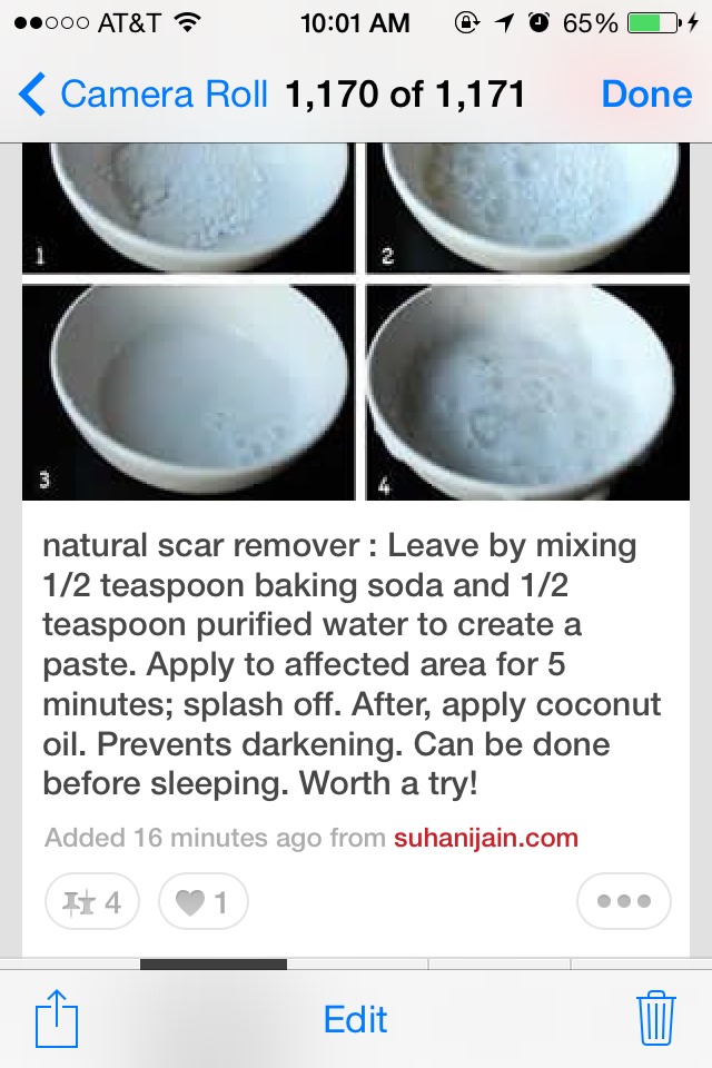 ✨✨Natural Scar Remover✨✨💁😊