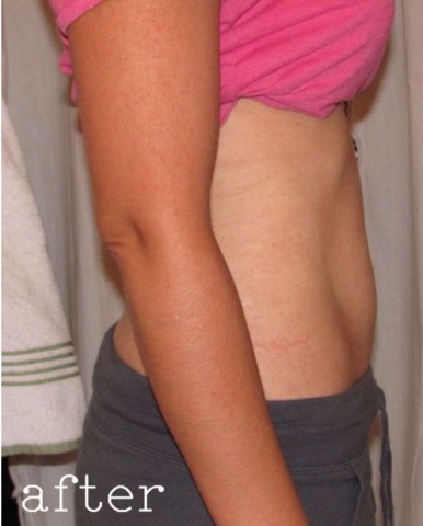 Lose Up To 1 Inch Over Night!!