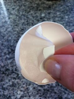 If emergency occurs... While the blood is gushing - hold pressure and crack open an egg. Peel that membrane off and put it on the wound (continue holding pressure) The membrane will harden and keep the wound closed until you can get to the ER for stitches.