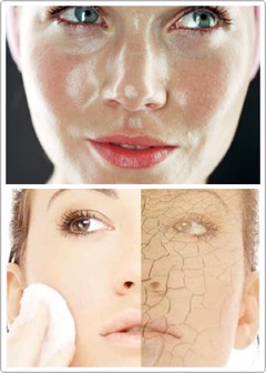 Oily vs dry skin.
What should I look for in a mask?