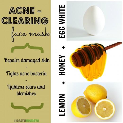 Acne Clearing Mask