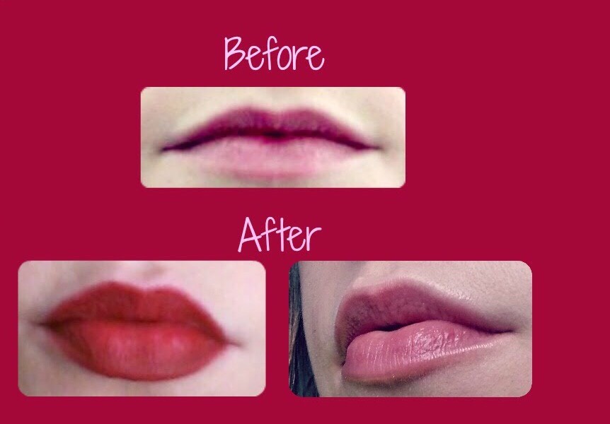 Others results 