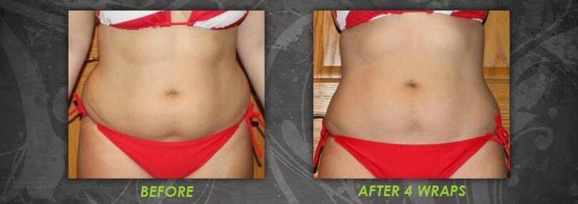 Easy Way To Slim Down Quickly ⏰👙🙋