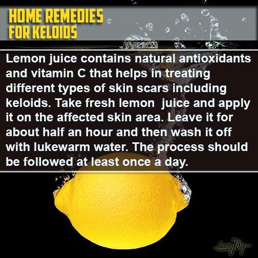 Natural Remedies, Something Or Other From Your Kitchen For Your Cure - Part 4 (Ayurveda)