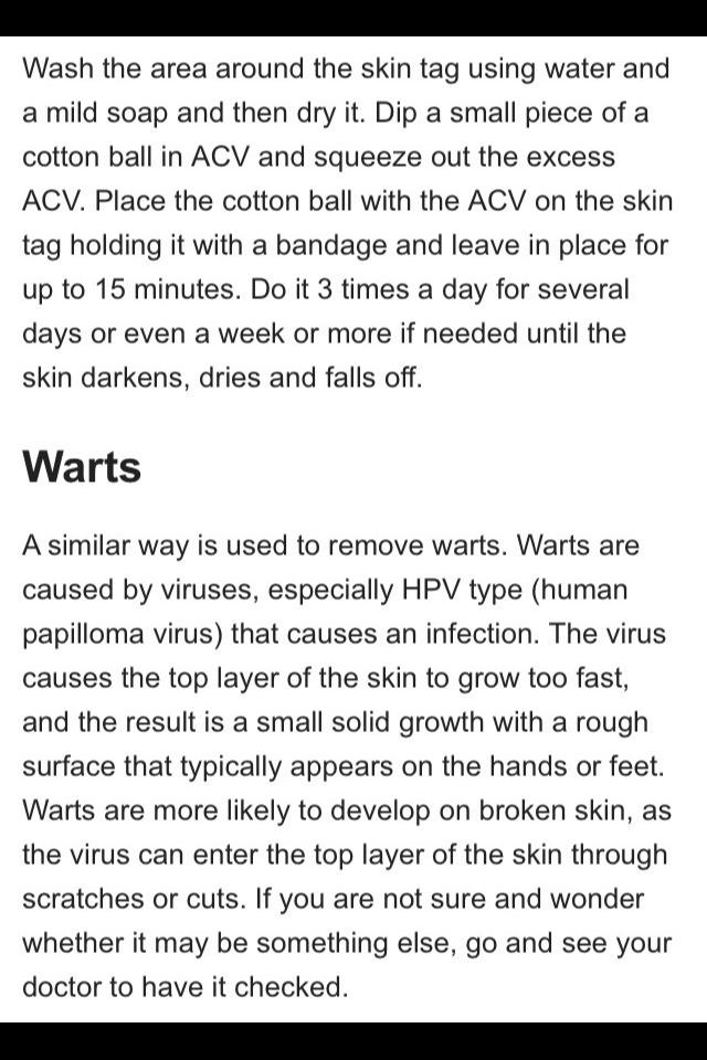 How To Remove Skin Tags And Warts Naturally And Cheaply At Home
