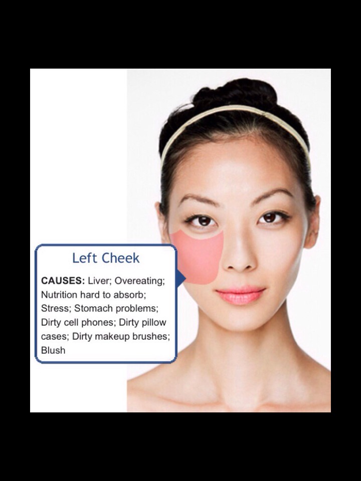 Face Mapping-What Your Acne Telling You? 😱👍👍