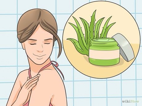 How To Get Rid Of Sunburn Overnight #greengoddess