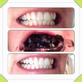 Natural Teeth Whitening😁✨👌