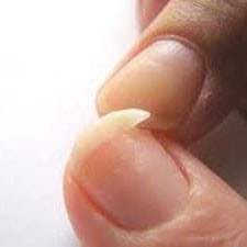 When nails split 90% of the time it is due to lack of proper moisture.
