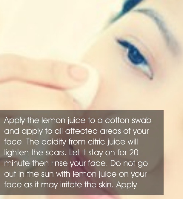 Natural Remedy To Rid Of Acne Scars Using A Lemon :) 
