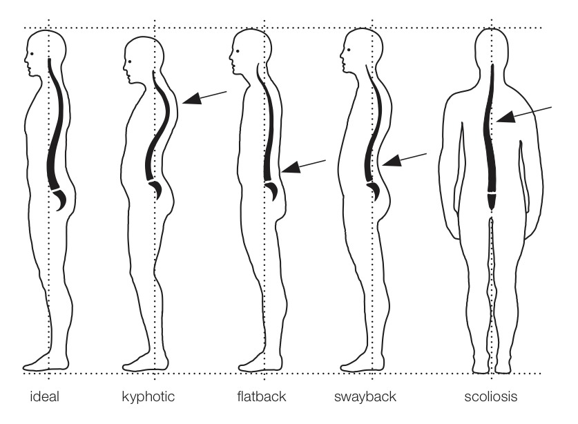 Posture
