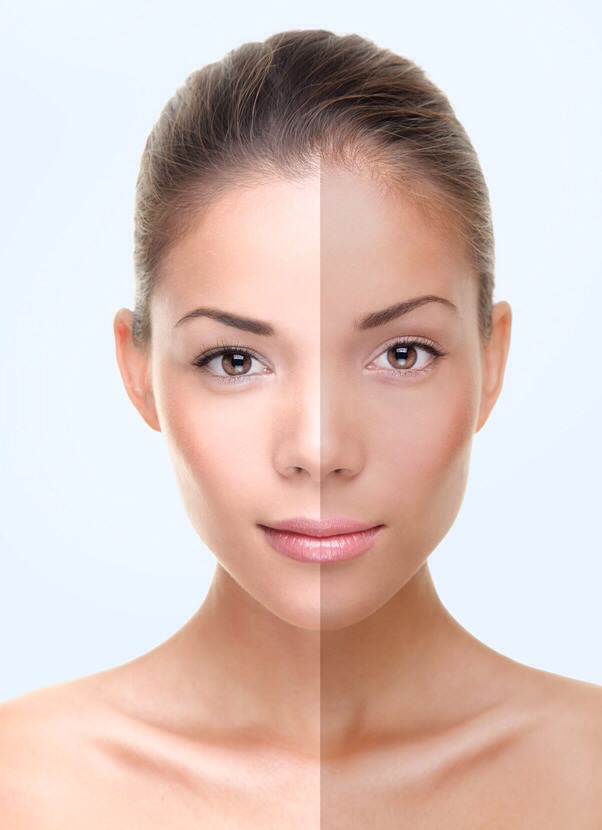 Lightens skin