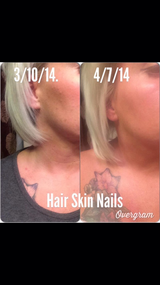 Easy Way To Grow Hair Fast