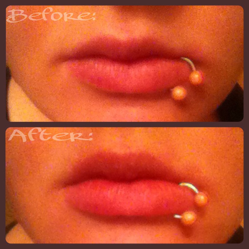 Enough with the logistics already, huh? Let's get down to results! Now please note, I was blessed with decent sized lips as it is but my personal favorite is the big round one, that's what I used here. This was also one of my first tries so if it's not super noticeable right away, give it time!