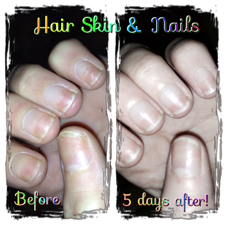 These are my nails! I had been taking this for ONLY 5 days!!! 

http://trishtightentone.myitworks.com