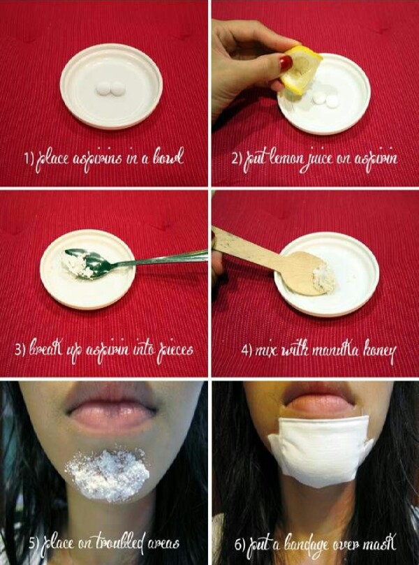 DIY Honey Aspirin Acne Mask!