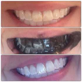 Natural Teeth Whitening😁✨👌