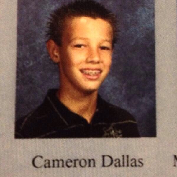 Cameron Dallas had braces