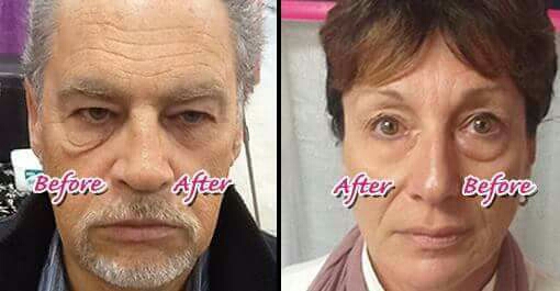 You could have flawless skin in just 2 minutes... 