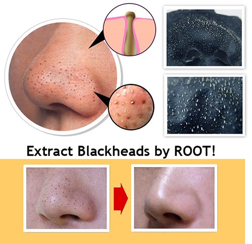 Best Black Mask- Get Rid Of Pores