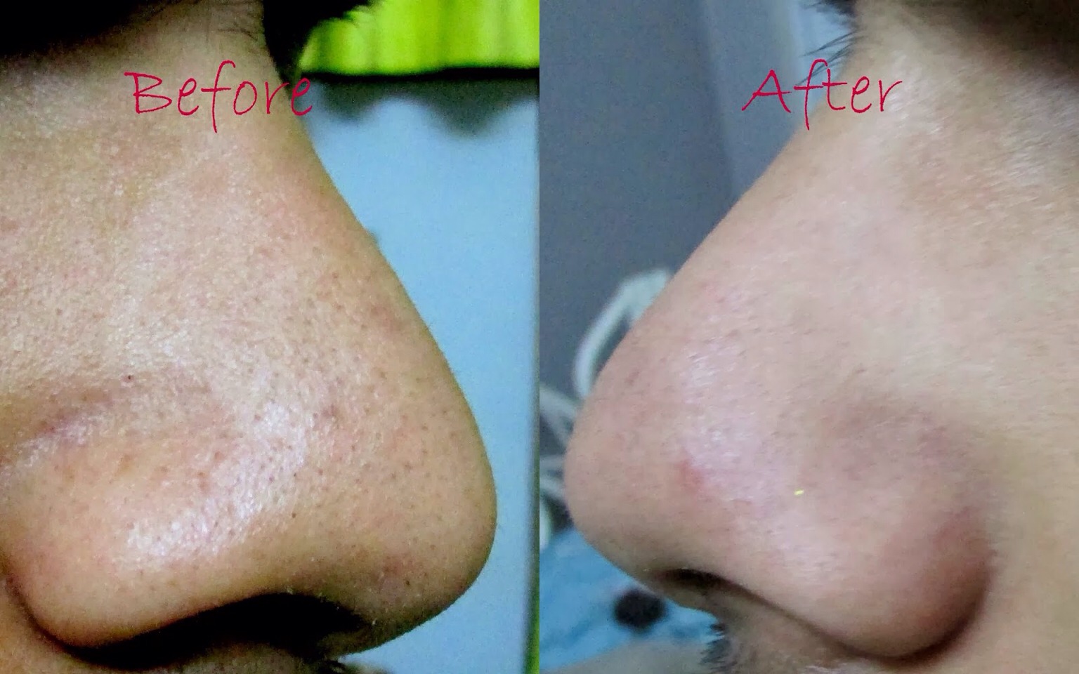 In one session of an hour and fifteen minutes you will have glowing skin. Go to a hot yoga studio and try a free trial you won't be disappointed !!  Like and share ! Thanks    