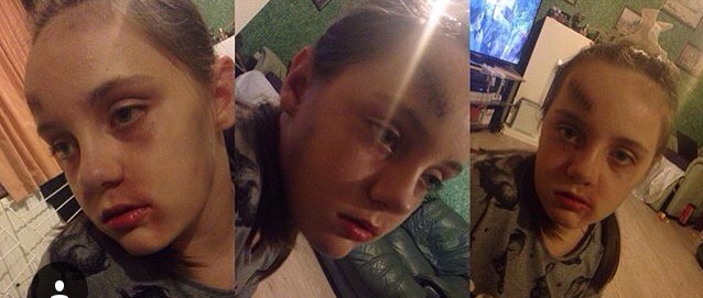 For this halloween makeup you will need:
A black pencil
Black and brown shadow
Red power(for around the eyes)
Fake blood(for around the scar)