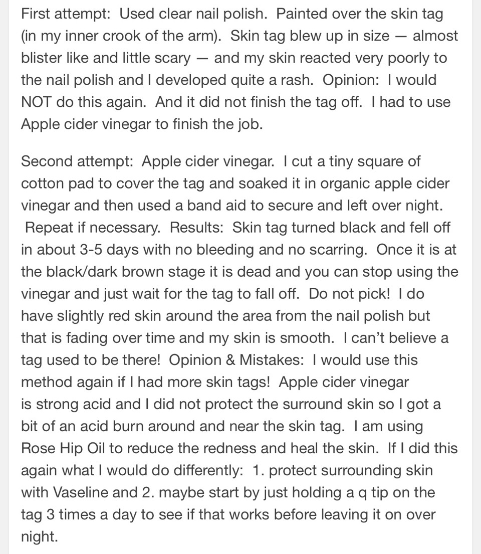 How To Remove Skin Tags With One Simple Ingredient. 😊
