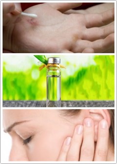 🌿Relieves asthma or other breathing conditions when a few drops are added to a humidifier.
🍃Works as as antiseptic on small cuts.
🌱Keeps your bathroom fresh.
🌿Relieves earaches; mix 1 drop of tea tree oil with 1 tsp. olive oil, drop mixture into the ear + then remove by tilting head.
